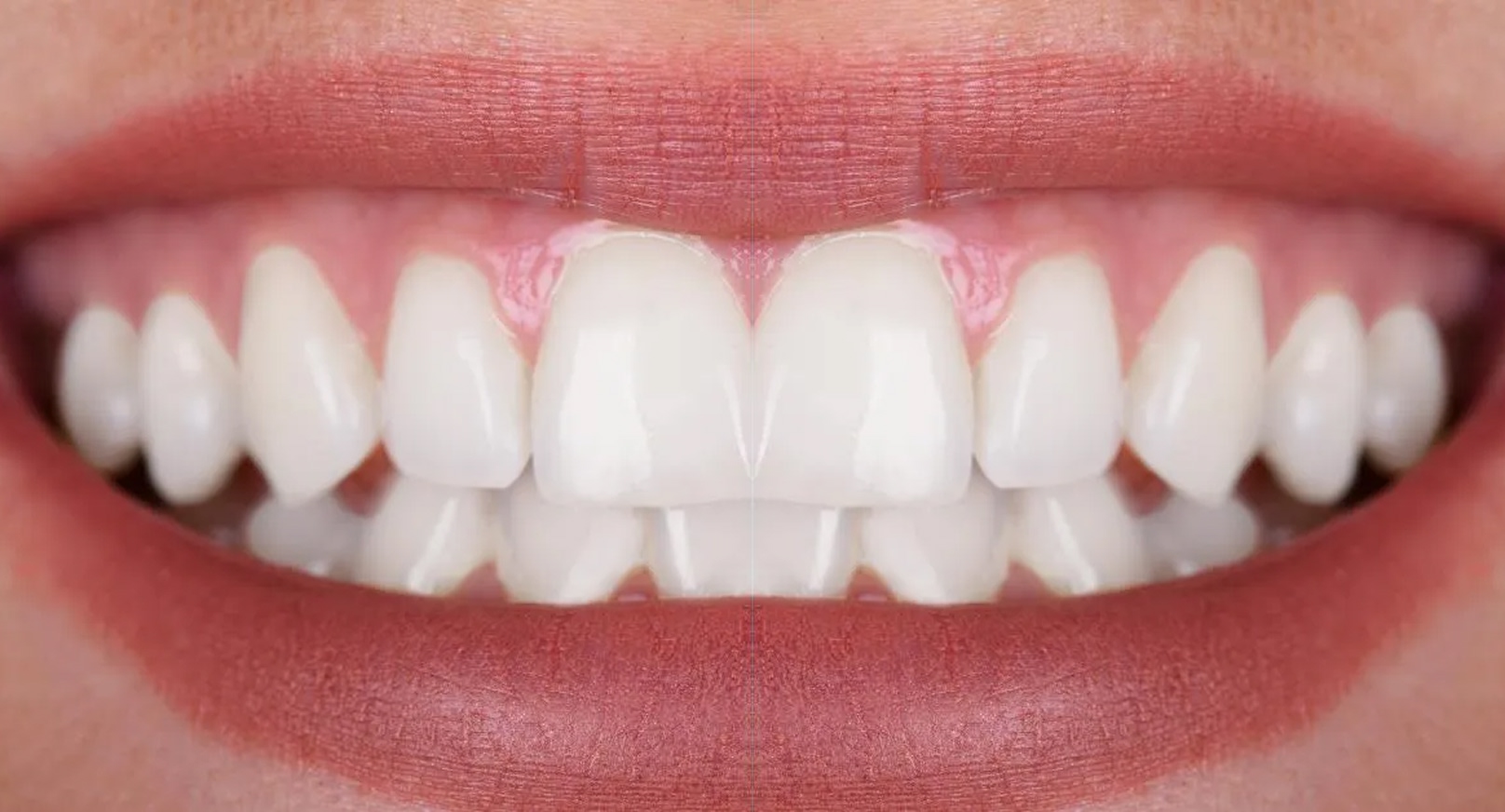 comparison_after