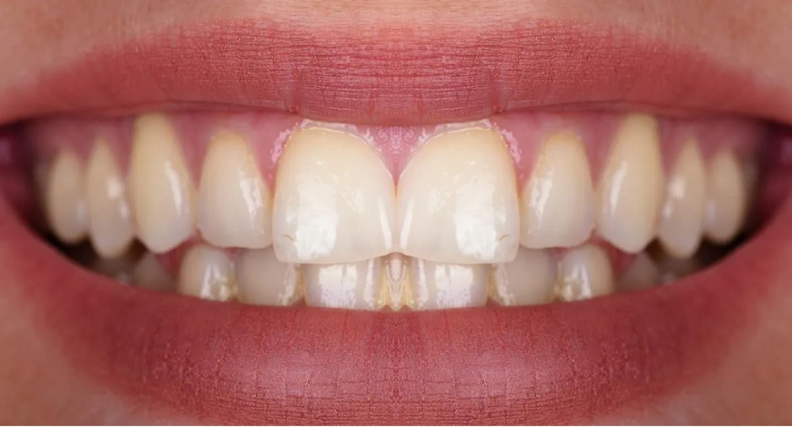 comparison_before